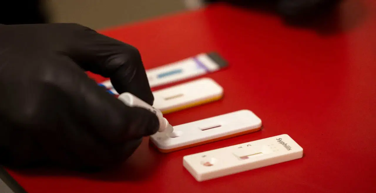 İzmir’de cinsel yolla bulaşan hastalıklar için ücretsiz test dönemi