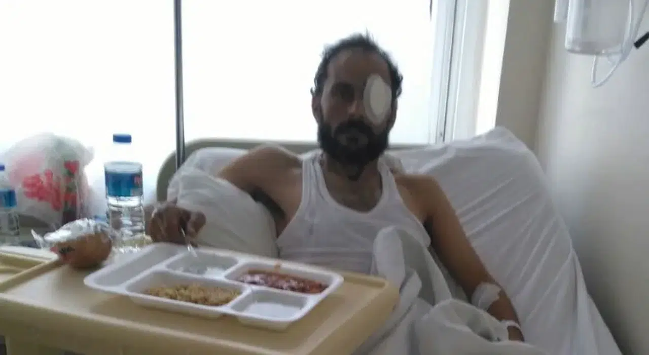 Hastaneler yaralı ÖSO'cularla doldu