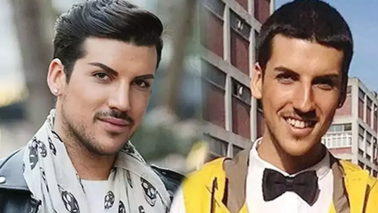 Kerimcan Durmaz'ın estetiksiz hali