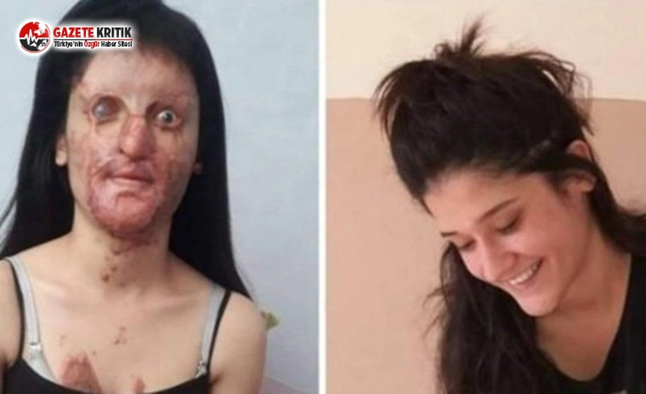 Berfin’in yüzüne kezzap atmıştı: Cezası 13 yıl