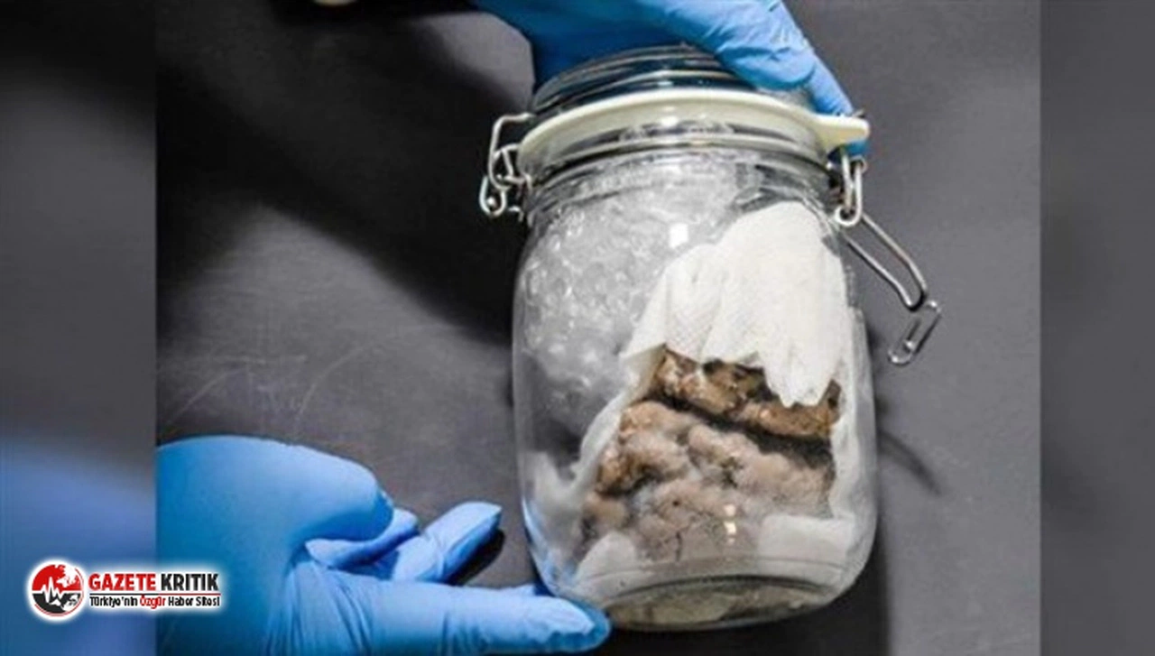 Kanada sınırında kavanoz içinde insan beyni bulundu