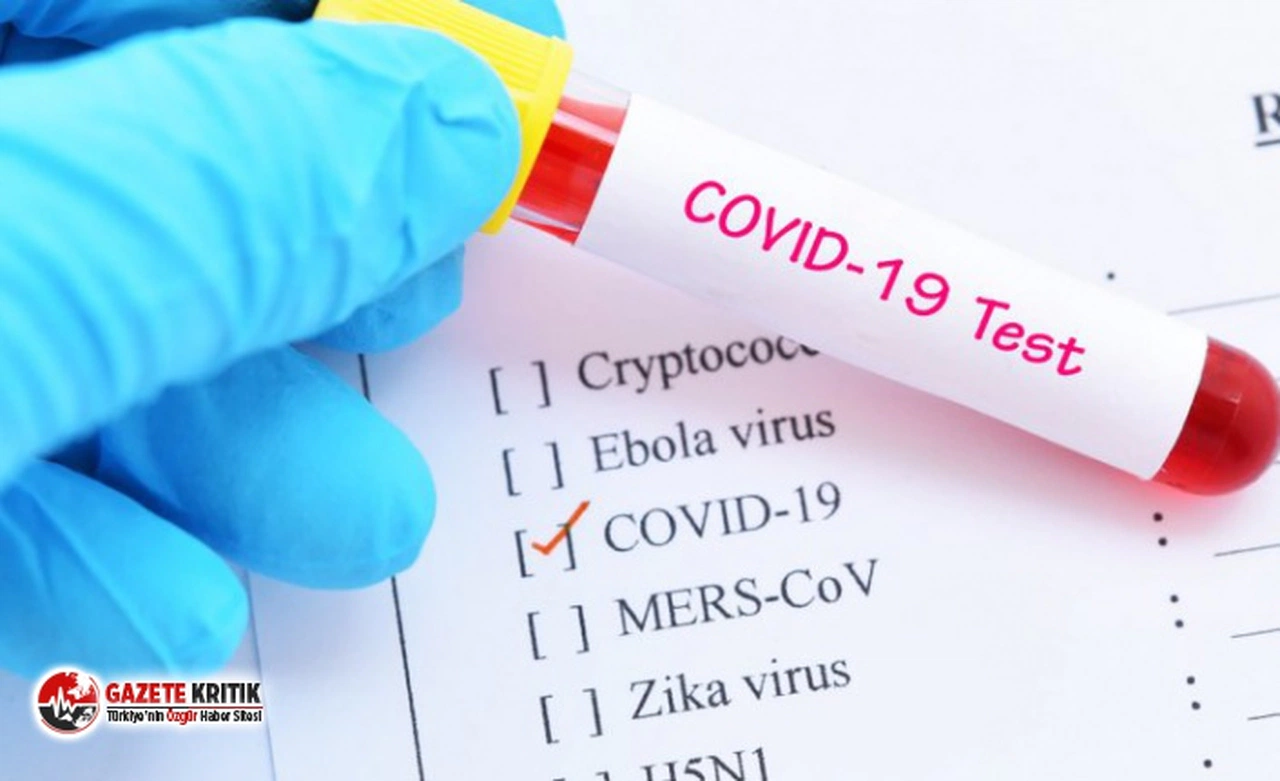 Ölüm raporuna 'doğal ölüm' yazılan hastanın test sonucu pozitif çıktı!