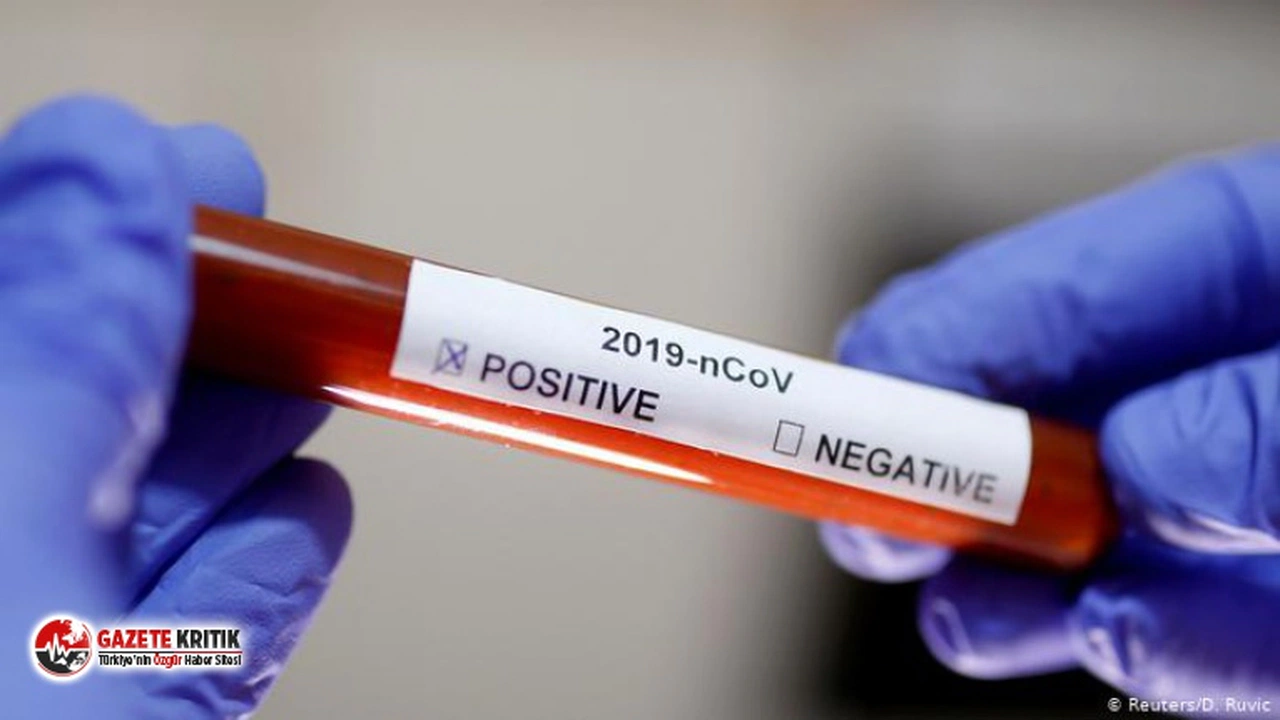 ABD’den, koronavirüsü dakikalar içinde tespit eden antikor testine izin