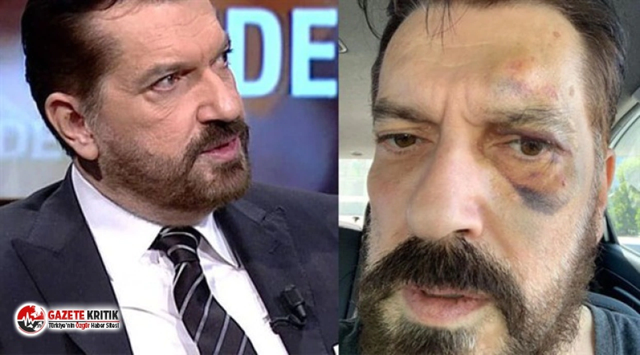 Anket şirketi başkanı Hakan Bayrakçı darp edildiği anları anlattı: "Tek gel dedim 5 kişi geldiler"