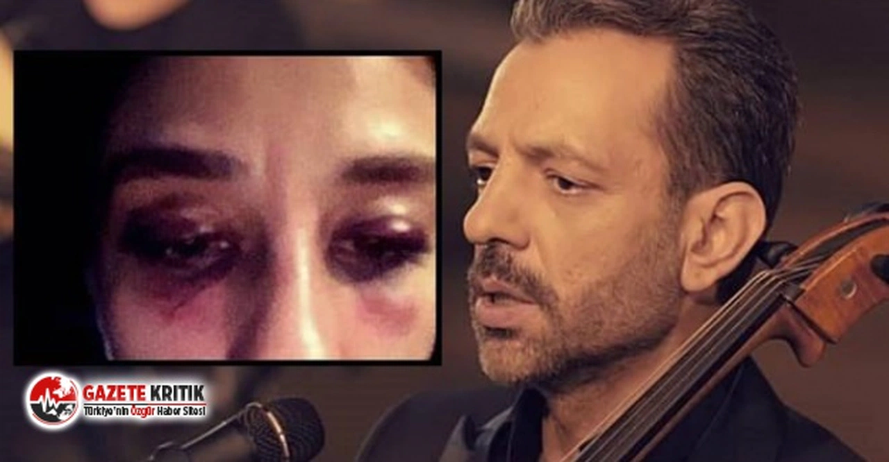 Sevgilisini darp ettiği iddia edilen RUBATO'nun solisti Arkun: 'Elim burnuna çarptı'