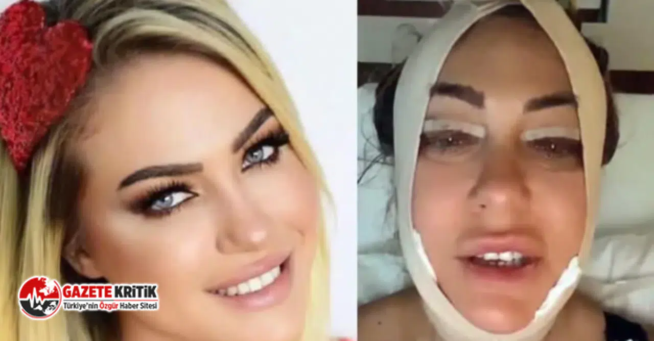 Yeliz Yeşilmen, güzelleşmek için bıçak altına yattı