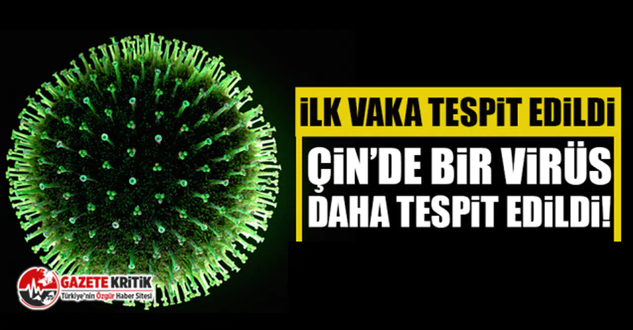 Çin'de bir virüs daha tespit edildi! İlk vaka tespit edildi