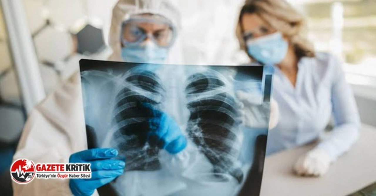 Kovid-19'dan ölen bir kişinin akcigerleri görüntülendi!