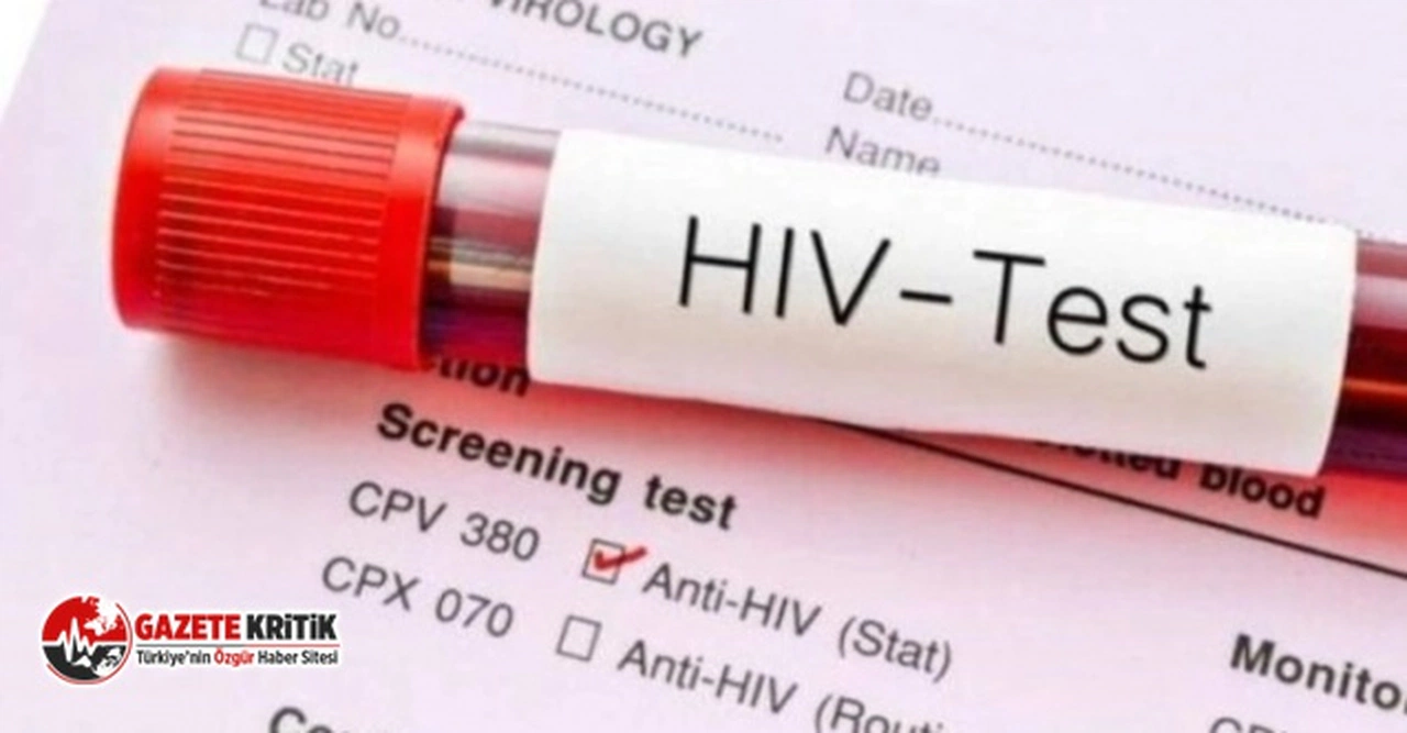 Türkiye’de AIDS alarmı! Binlerce vaka var