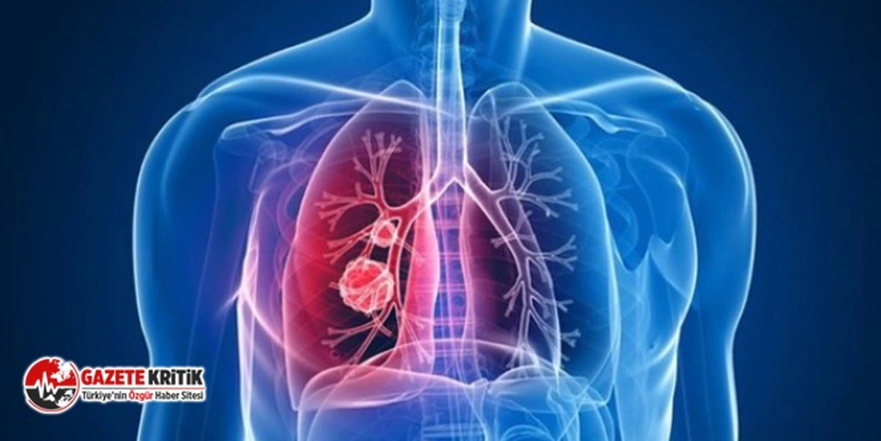 TÜRKİYE’DE 5 MİLYONDAN FAZLA KOAH HASTASI VAR