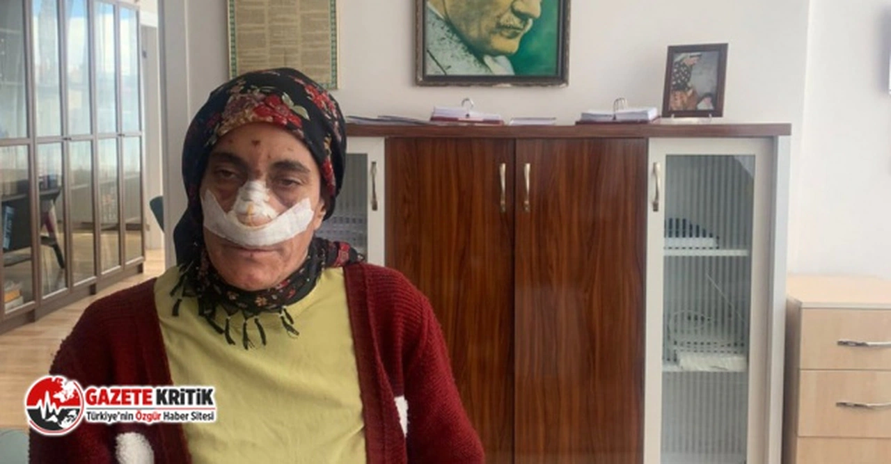 İmam, toplanan paranın akıbetini soran kadını darbetti!