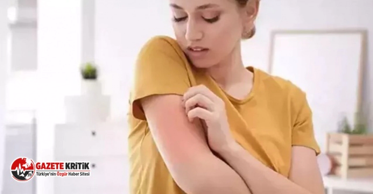 “Kliniklerdeki uyuz vakaları yüzde 25’e yükseldi”