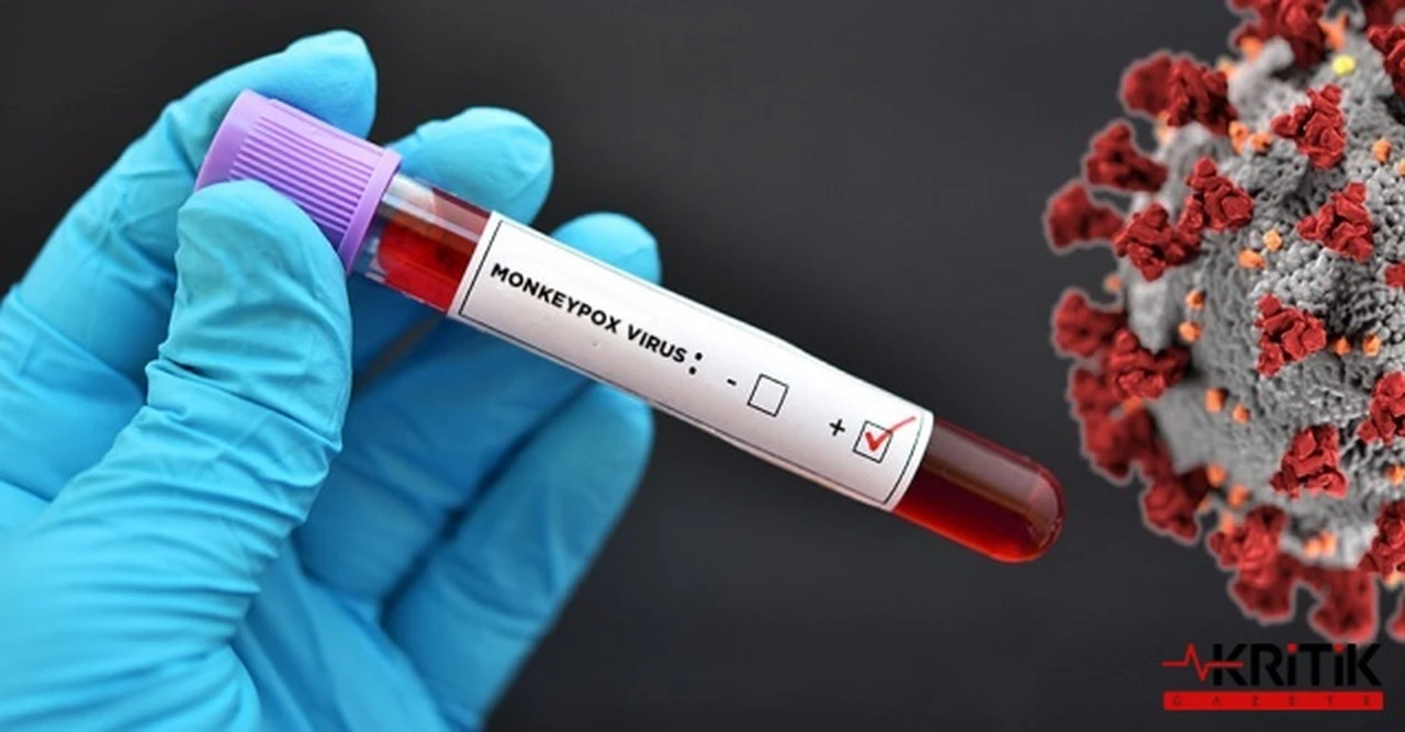 CHP'DEN İKTİDARA:MAYMUN ÇİÇEĞİ EYLEM PLANINIZ VAR MI?