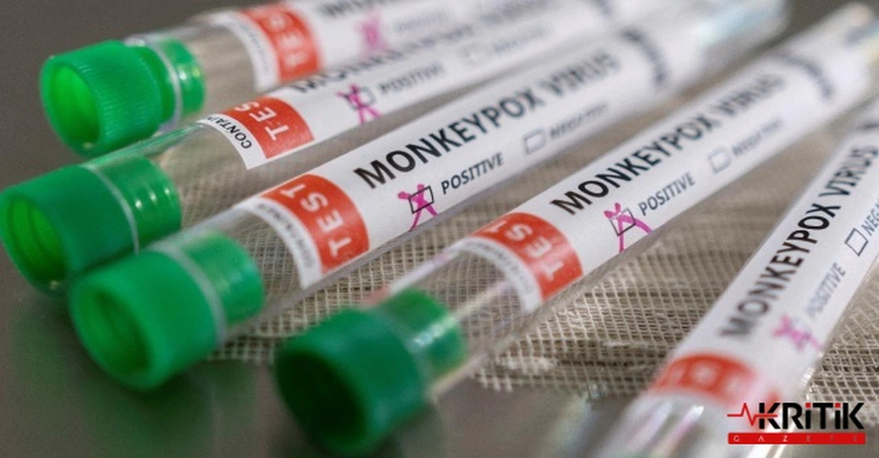 Dünya Maymun Çiçeği Salgını İçin Önlem Alırken AKP Ülkeyi Yol Geçen Hanına Çevirdi!