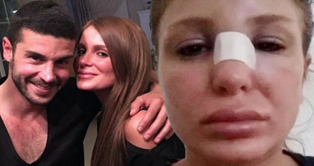 Berk Oktay ve Merve Şarapçıoğlu arasında sular durulmuyor