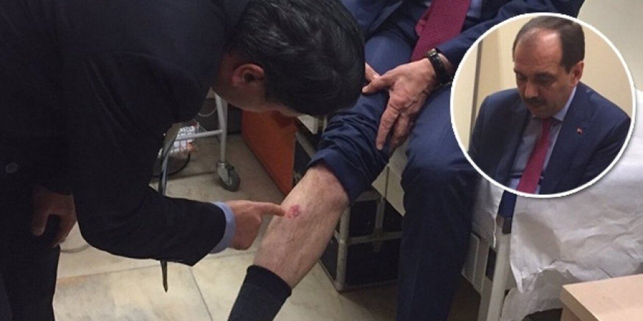 CHP'li Özgür Özel: Şamil Tayyar iddiasını ispatlarsa, gelip beni ısırabilir