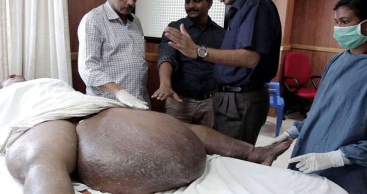 Sivrisinekten kaptığı parazit hayatını karartı