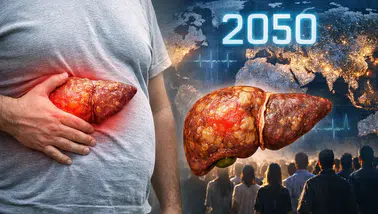Metabolik karaciğer hastalığında alarm: 2050’ye kadar 1,8 milyar kişi etkilenebilir