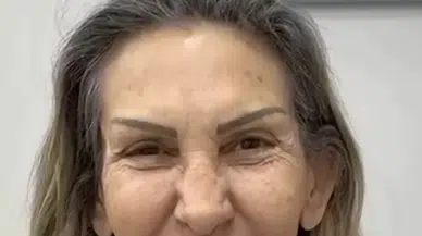 Petek Dinçöz’ün Annesi Estetikle Gençleşti: Sosyal Medya Şaşkın!