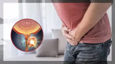 Prostat kanserinde çarpıcı oranlar: 70 yaşından sonra risk artıyor