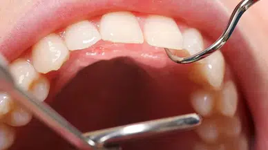 7 kardeşin de dişleri yok