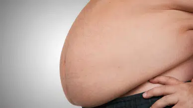 Abla kardeş obeziteyle savaşıyor… Henüz 2,5 yaşında 50 kiloya ulaştı