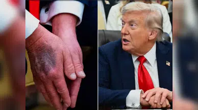 Beyaz Saray’dan Trump’ın sağlık durumu açıklaması: Hastanede iddialarına yanıt geldi