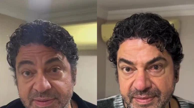 Hakan Taşıyan’ın Botoks Kararı Sosyal Medyada Gündem Oldu!