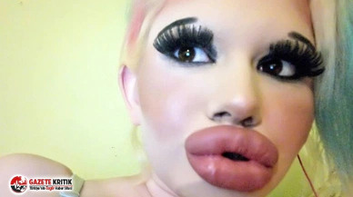 Dünyanın en büyük dudaklarına sahip olmak için 15 operasyon geçirdi