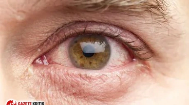 Koronavirüs gözden de bulaşabiliyor