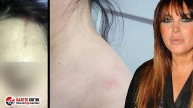 Serengil, Covid19 çıkan yardımcısını darp edip ormana attı