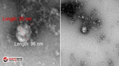 İşte mutasyon geçiren koronavirüsün ilk fotoğrafı