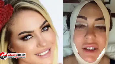 Yeliz Yeşilmen, güzelleşmek için bıçak altına yattı