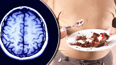 Bilim insanları:Aşırı kilo, beyinde küçülmeye neden olabilir