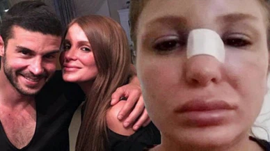 Berk Oktay ve Merve Şarapçıoğlu arasında sular durulmuyor