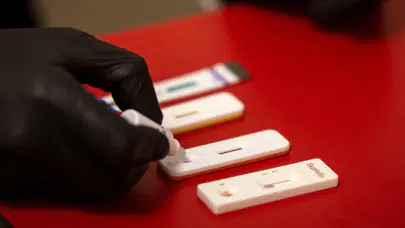 İzmir’de cinsel yolla bulaşan hastalıklar için ücretsiz test dönemi