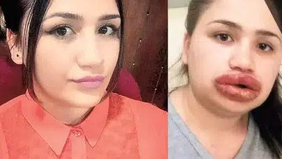 Türkiye onu dudaklarıyla tanımıştı! İşte son hali