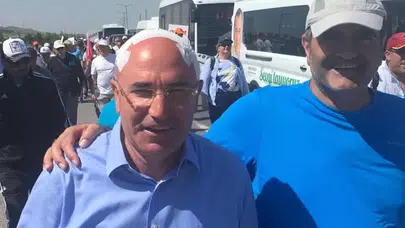 Adalet Yürüyüşü'nde görünmez kaza!.. Vekil başını çarptı