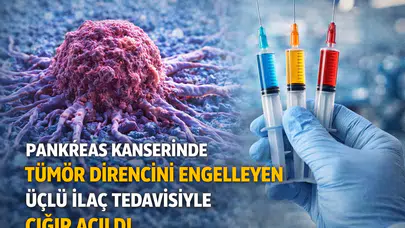 Pankreas Kanserinde Tümör Direncini Engelleyen Üçlü İlaç Tedavisiyle Çığır Açıldı