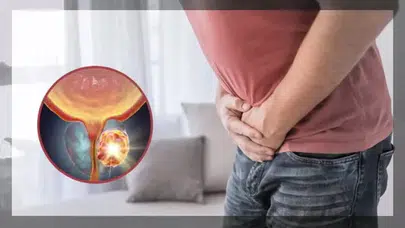 Prostat kanserinde çarpıcı oranlar: 70 yaşından sonra risk artıyor