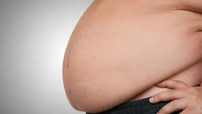 Abla kardeş obeziteyle savaşıyor… Henüz 2,5 yaşında 50 kiloya ulaştı