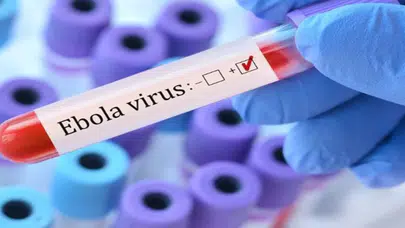 Ebola alarmı: Salgın kontrolden çıkma riskiyle karşı karşıya