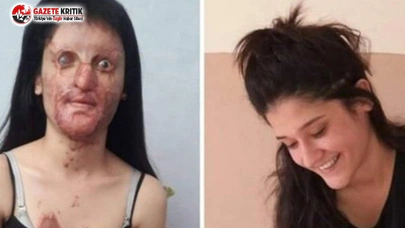 Berfin’in yüzüne kezzap atmıştı: Cezası 13 yıl