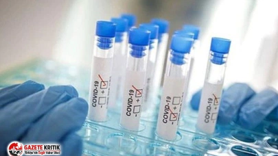 Koronavirüs hakkında çok konuşulacak araştırma: Tüm organlara saldırıyor