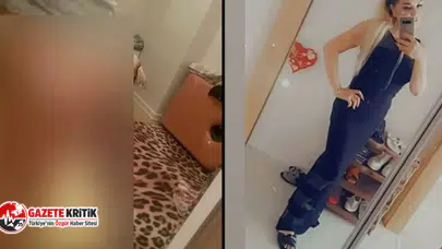 Bir estetik kurbanı daha: Yanlış estetik hayatını mahvetti