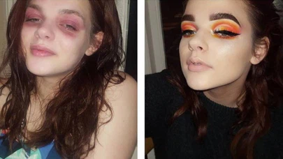 Instagram'daki en anlamlı before-after fotoğrafı