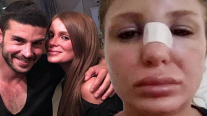 Berk Oktay ve Merve Şarapçıoğlu arasında sular durulmuyor