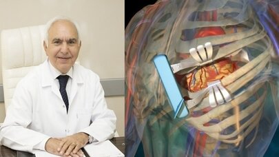 İlaç-Stent-Bypass, kalp damar hastalıklarında hayat kurtarıyor