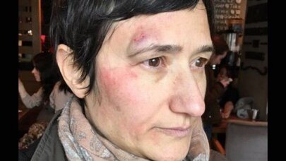 İLEF'in eski hocası Şeyda Sever'e polis saldırısı