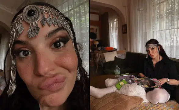 Aslı Bekiroğlu’ndan 5. Ameliyat Sonrası Yeni Paylaşım: “Süsümüzden Ödün Verecek Değiliz”